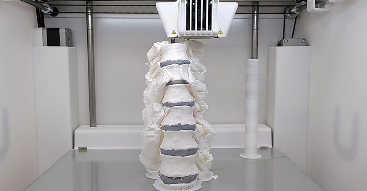 Un laboratori 3D permet als facultatius de l&rsquo;Hospital Verge de la Cinta simular cirurgies complexes